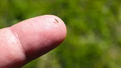 Ako sa zbaviť triesok bez ihiel a bolesti